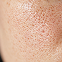 Extreme Close-Up Pores and Skin Texture